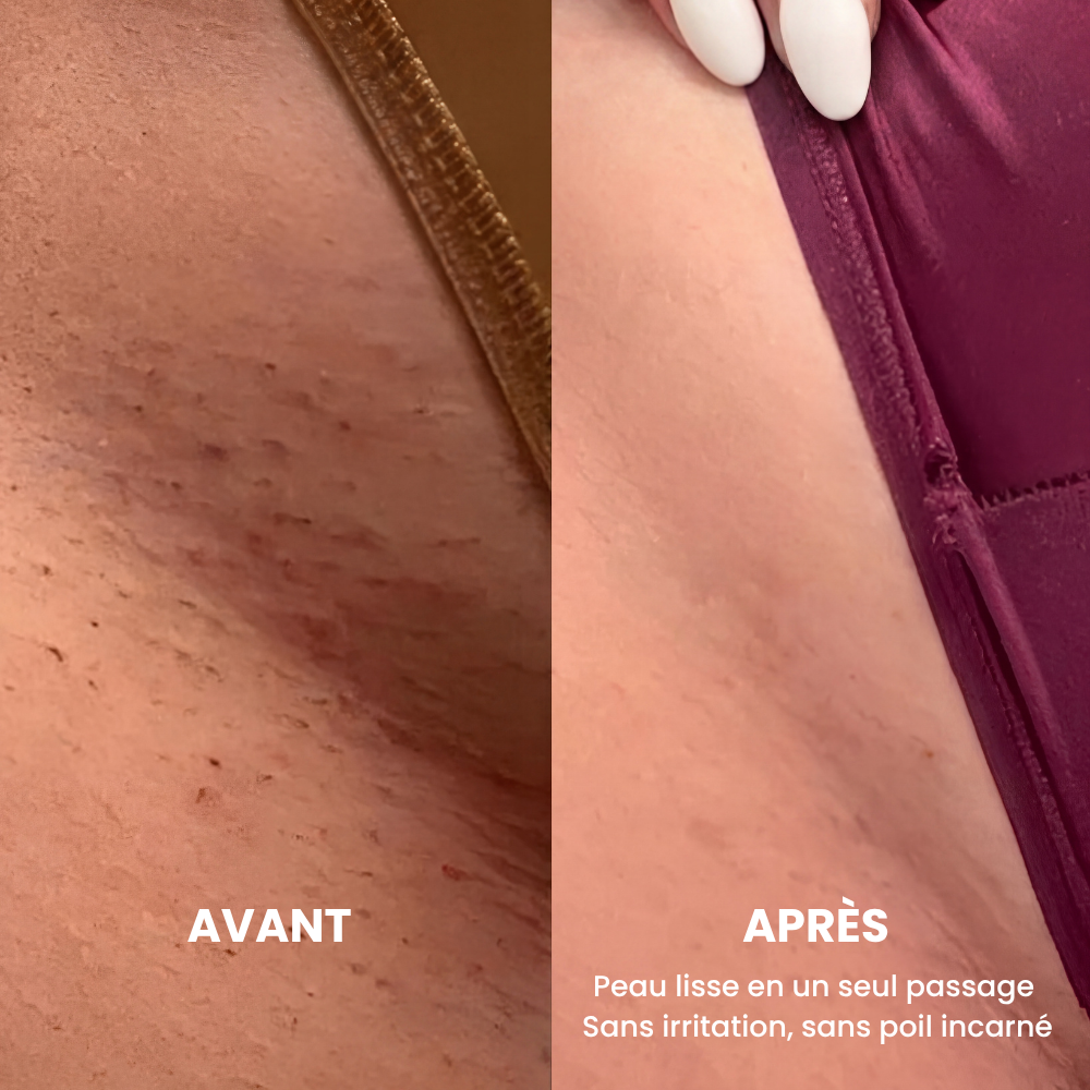 Le Rasoir Elisse